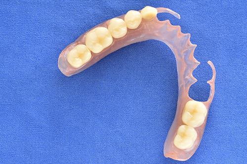 Dentures